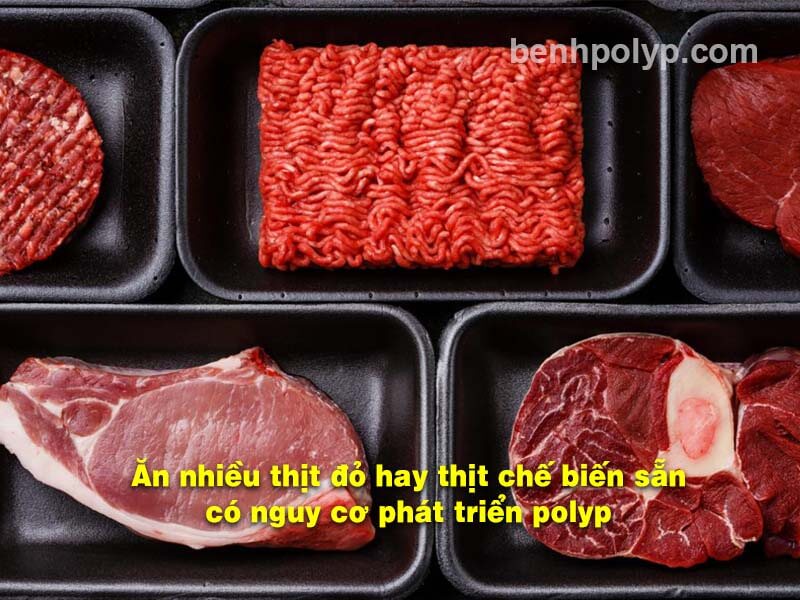 Ăn nhiều thịt đỏ được xem là nguyên nhân hàng đầu gây ra polyp trong túi mật